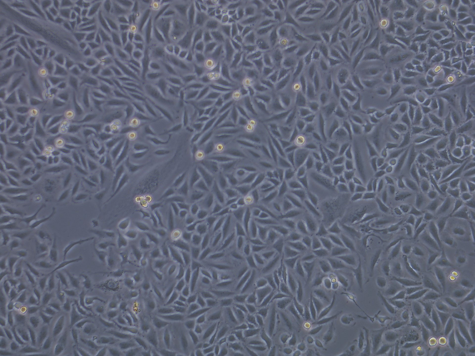 SiHa cells (人子宮頸鱗癌細胞))